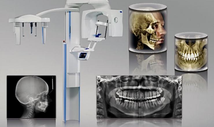radiografia3D